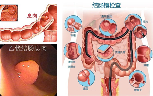 經(jīng)常放屁是在“排毒”？或許“根源”在腸道！